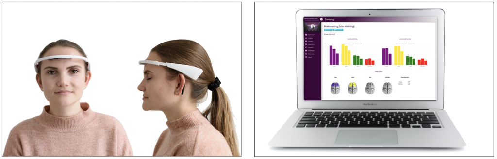Dashboard Brainmarker